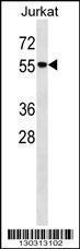 Anti-MAPK14 Rabbit Polyclonal Antibody