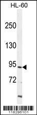 Anti-ITIH1 Rabbit Polyclonal Antibody (HRP (Horseradish Peroxidase))