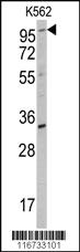 Anti-ROR2 Rabbit Polyclonal Antibody