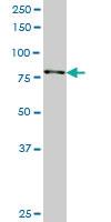 Anti-RPS6KA3 Mouse Monoclonal Antibody [clone: 2G10]