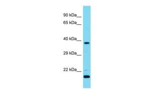 Anti-CAMK1D Rabbit Polyclonal Antibody