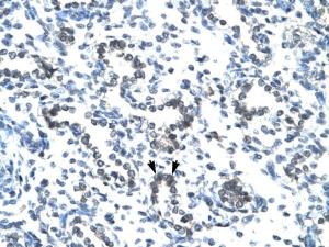 Anti-EVX1 Rabbit Polyclonal Antibody