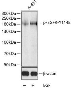 Western blot analysis of extracts of A-431 cells, using Anti-EGFR (phospho Tyr1148) Antibody (A10875) at 1:1000 dilution