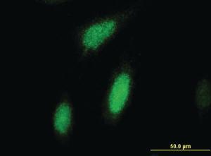 Anti-RPS6KA3 Mouse Monoclonal Antibody [clone: 2G10]