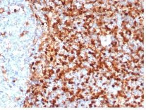 Immunohistochemical analysis of formalin-fixed, paraffin-embedded human tonsil tissue using Anti-Annexin A1 Antibody [rANXA1/6451]