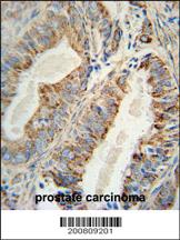 Anti-AKT2 Mouse Monoclonal Antibody