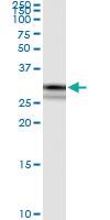 Anti-CRYZ Rabbit Polyclonal Antibody