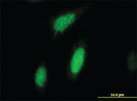 Anti-RPS6KA3 Mouse Monoclonal Antibody [clone: 2G10]