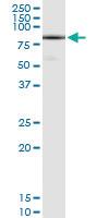 Anti-DHX58 Polyclonal Antibody Pair