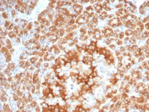 Anti-RCAS1 antibody