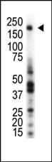 Anti-MST1R Rabbit Polyclonal Antibody