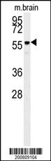 Anti-AKT2 Mouse Monoclonal Antibody