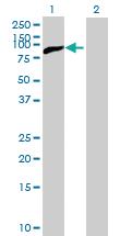 Anti-RPS6KB1 Mouse Polyclonal Antibody