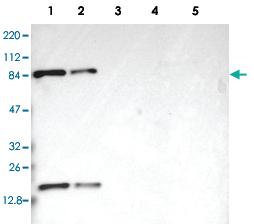 Anti-CD2AP Rabbit Polyclonal Antibody