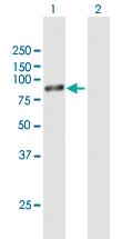 Anti-RPS6KB1 Mouse Polyclonal Antibody