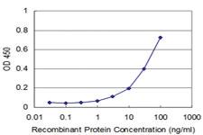 Anti-NUDT4 Mouse Monoclonal Antibody [clone: 2F2]