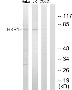 Antibody anti-HKR1 100 µg