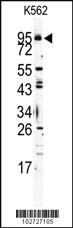 Anti-TLR6 Rabbit Polyclonal Antibody