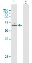 Anti-KAT5 Rabbit Polyclonal Antibody