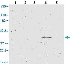 Anti-ZDHHC15 Rabbit Polyclonal Antibody