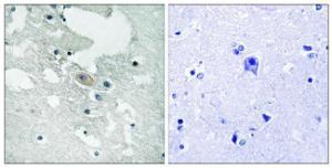 Immunohistochemical analysis of paraffin-embedded human brain using Anti-BLNK (phospho Tyr84) Antibody. The right hand panel represents a negative control, where the Antibody was pre-incubated with the immunising peptide