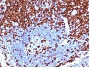 Immunohistochemical analysis of formalin-fixed, paraffin-embedded human lymph node tissue using Anti-CD5 Antibody [C5/4561R]