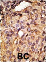 Anti-TLR6 Rabbit Polyclonal Antibody