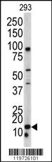 Anti-BAALC Rabbit Polyclonal Antibody