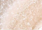 Anti-MAP1LC3A Rabbit Polyclonal Antibody (AP (Alkaline Phosphatase))