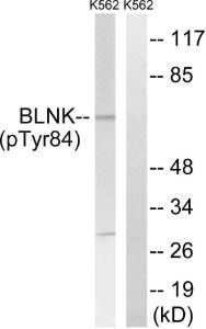 Western blot analysis of lysates from K562 cells treated with starved 24 h using Anti-BLNK (phospho Tyr84) Antibody. The right hand lane represents a negative control, where the Antibody is blocked by the immunising peptide