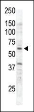 Anti-RYK Rabbit Polyclonal Antibody