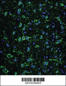 Anti-MAP2 Mouse Monoclonal Antibody