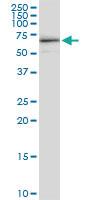 Anti-KAT5 Rabbit Polyclonal Antibody