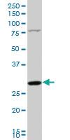 Anti-NUDT5 Mouse Polyclonal Antibody