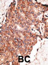 Anti-BMP1 Rabbit Polyclonal Antibody (HRP (Horseradish Peroxidase))