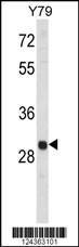 Anti-MAPK1IP1L Rabbit Polyclonal Antibody (HRP (Horseradish Peroxidase))