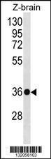 Anti-HOXD10 Rabbit Polyclonal Antibody (Biotin)