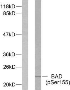 Western blot analysis of lysates from 293 cells treated with Forskolin using Anti-BAD (phospho Ser155) Antibody The left hand lane represents a negative control, where the antibody is blocked by the immunising peptide