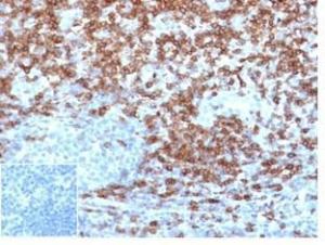 Immunohistochemical analysis of formalin-fixed, paraffin-embedded human tonsil using Anti-CD5 Antibody [C5/4561R] at 2µg/ml in PBS for 30 minutes at room temperature. Inset: PBS instead of the primary antibody. Secondary antibody negative control.