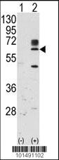 Anti-RYK Rabbit Polyclonal Antibody