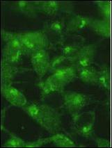 Anti-MAP1LC3A Rabbit Polyclonal Antibody (AP (Alkaline Phosphatase))