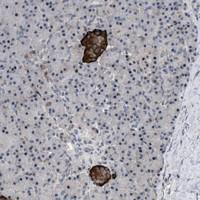 Anti-ZDHHC15 Rabbit Polyclonal Antibody