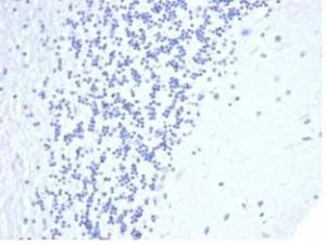 Negative Tissue Control: Immunohistochemical analysis of formalin-fixed, paraffin-embedded human brain using Anti-CD5 Antibody [C5/4561R] at 2µg/ml in PBS for 30 minutes at room temperature