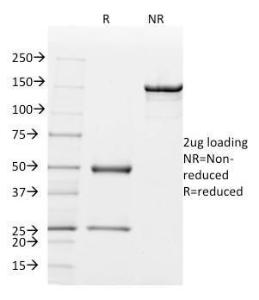 Anti-Mammaglobin A antibody