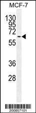 Anti-MAPK15 Mouse Monoclonal Antibody