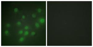 Antibody anti-HKR1 100 µg