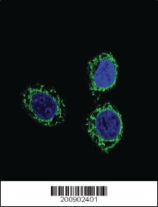 Anti-NPHS1 Mouse Monoclonal Antibody