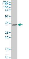 Anti-SNAI2 Mouse Monoclonal Antibody [clone: 2F11]