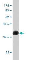 Anti-CUX1 Mouse Monoclonal Antibody [clone: 2D10]