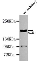 Anti-ACE Mouse Monoclonal Antibody [clone: 13k8]